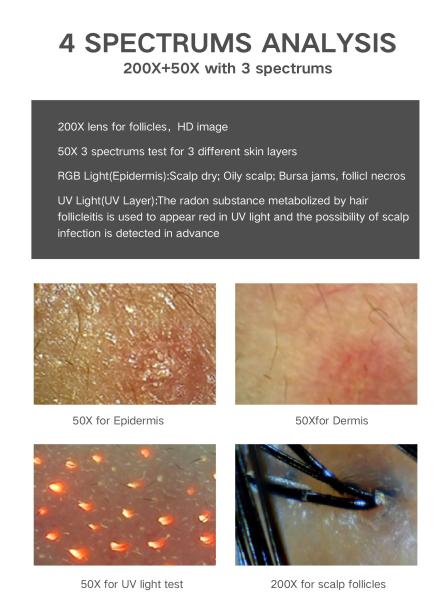 ABS PC 15 Inch HD Screen 200X Camera USB Digital Hair And Skin Analyzer