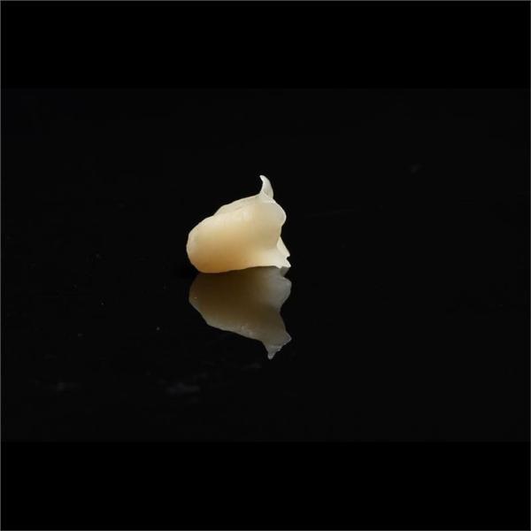Metal Free Composite Crowns Inlays And Onlays Bridges Implants ODM