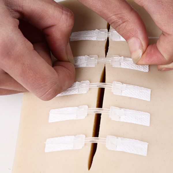 Surgeries Zip Wound Closure Device Plastic Material Multi - Sizes Without