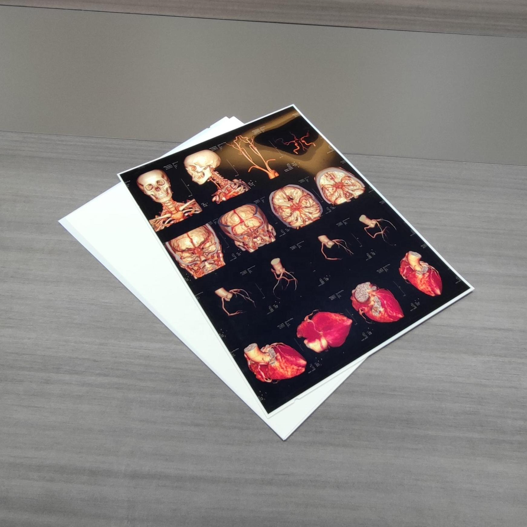 180 микронов фильма A3 струйного сухого отображая x Рэй медицинского для принтеров Epson канона