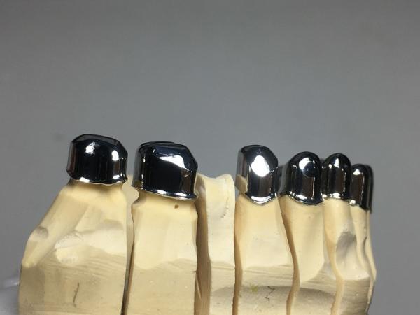 ODM Dental Prosthesis Crown Telescope Precision Attachment Denture