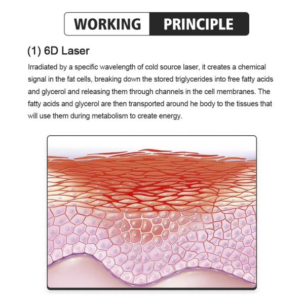 Máquina de congelación de grasa corporal no quirúrgica de enfriamiento por aire Equipo de contorno corporal